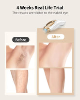 Hair Removal Unlimited Flashes 9 Gears Laser Ice-Cooling Painless Electric Depilator For Men Women